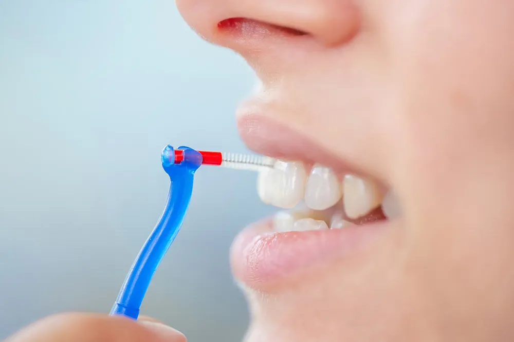 انٹرڈینٹل برش استعمال کرنے کا صحیح طریقہ
